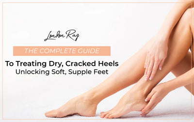 The Complete Guide to Treating Dry, Cracked Heels: Unlocking Soft, Supple Feet